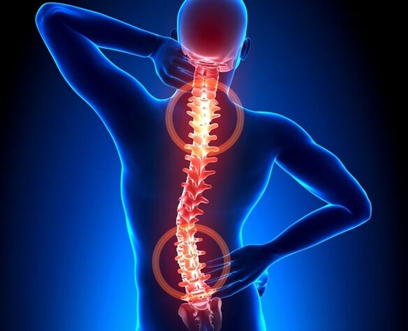 pain in the spine with osteonecrosis