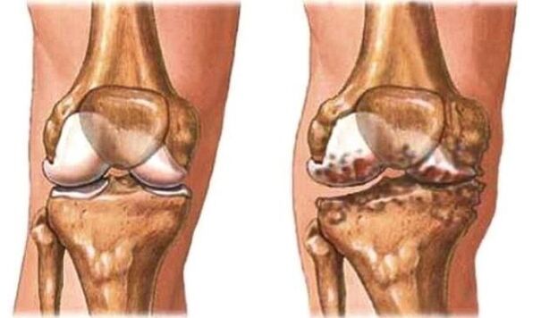 healthy knee and knee joint