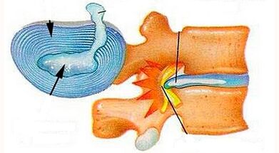 Characteristics of the growth of cervical bone