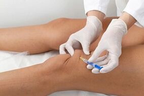injection into the knee joint to treat joint disease