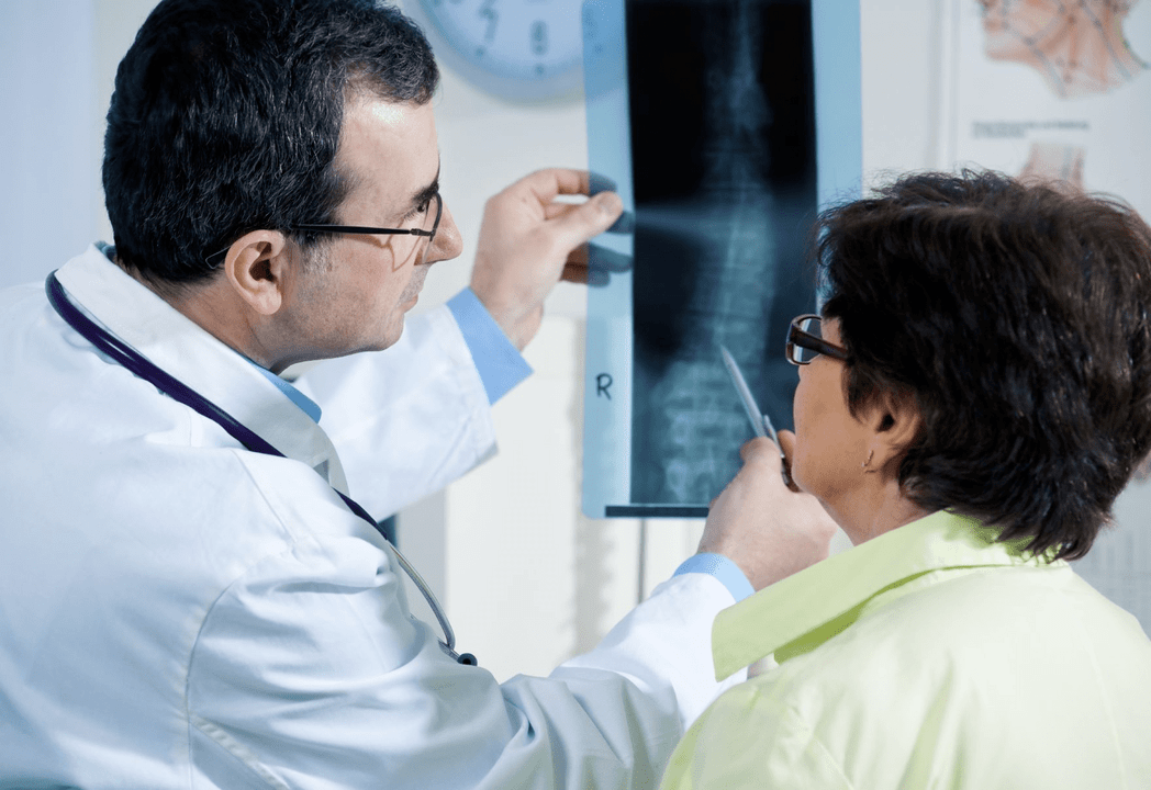 A neurologist diagnoses osteoarthritis using X-rays of the spine
