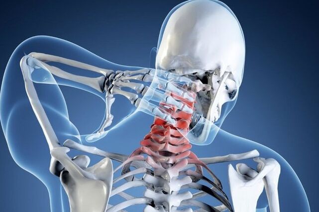 cervical spine degeneration