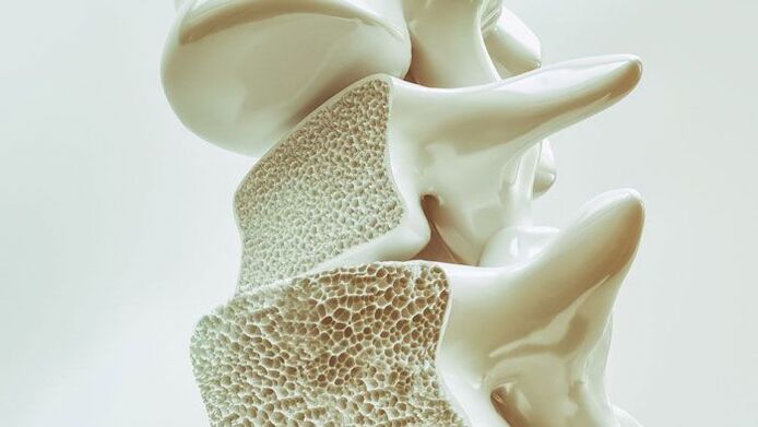 Cross-sectional model of the spine