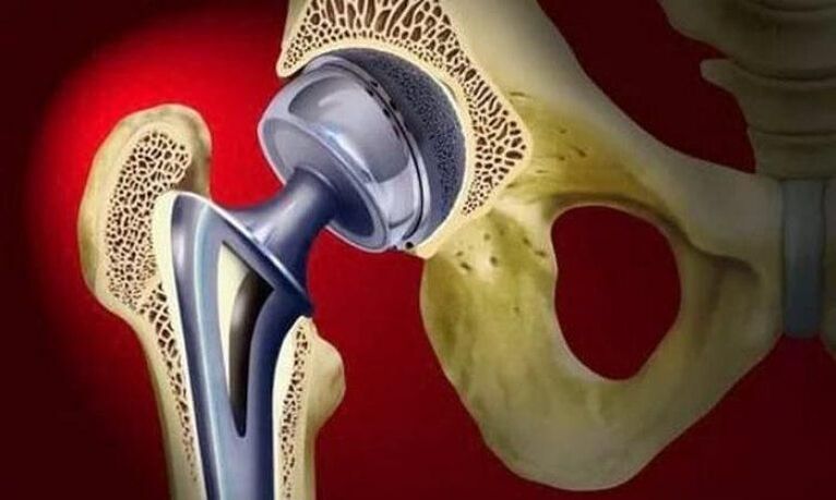 endoscopy